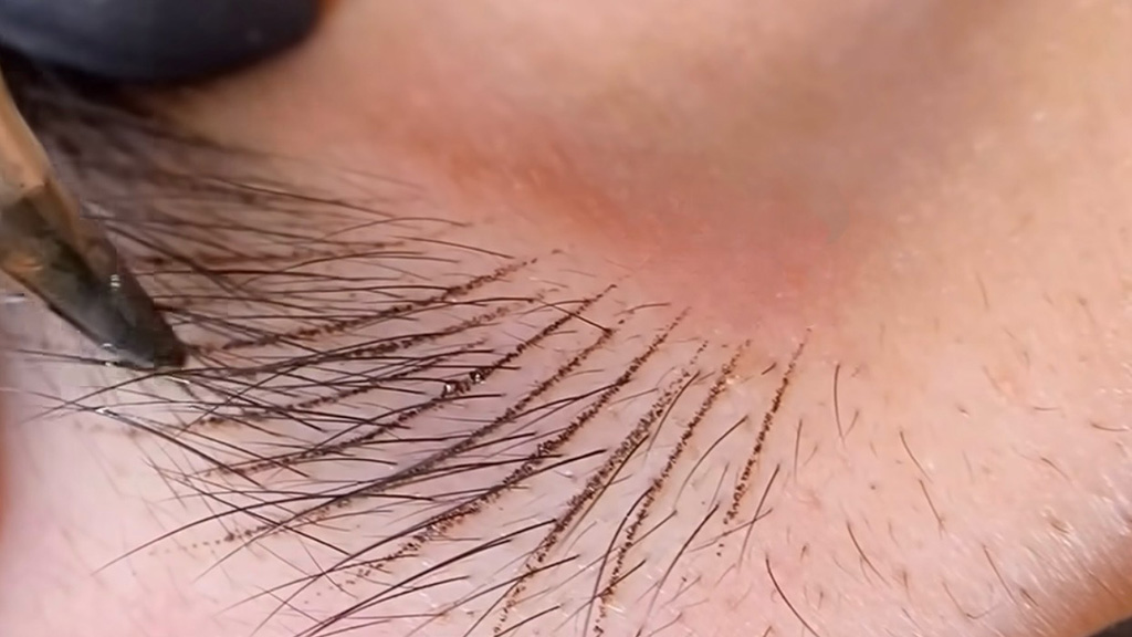 Nano Brows procedure at Dermaluxe Spa in Houston, TX