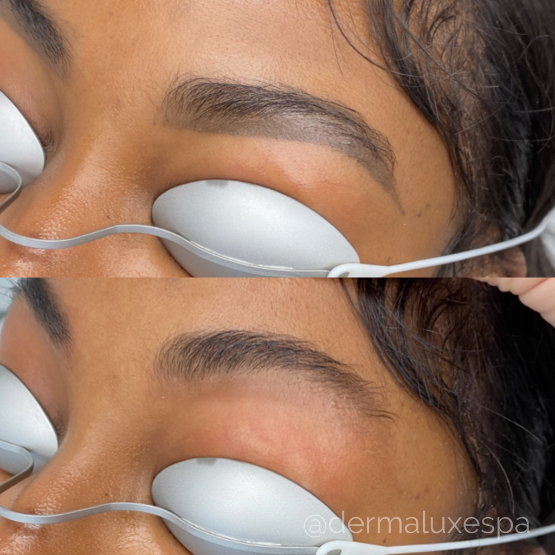 microblading eyebrow removal houston