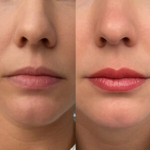 Lip Blushing near me Houston TX - Book online today at Dermaluxe Spa