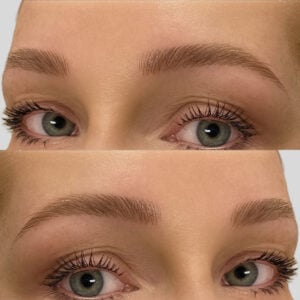 Gallery Before and After - Permanent Eyebrows Microblading from Dermaluxe Spa - Come To Dermaluxe Spa