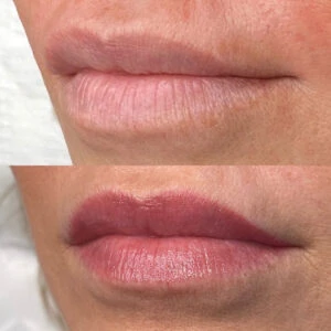Healed Lip Blush Houston - Before and After- Dermaluxe Spa