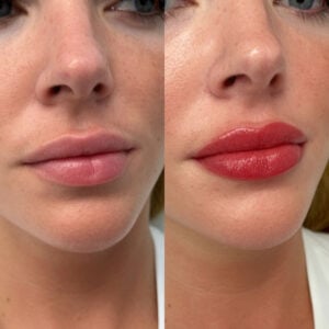 Best Lip Blushing Houston - Permanent Makeup - Dermaluxe Spa