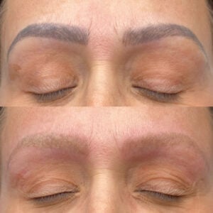 Remove Microblading Houston - Dermaluxe Spa Book online today!