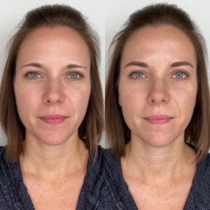 Permanent makeup eyebrows before and after results at Dermaluxe Spa Houston