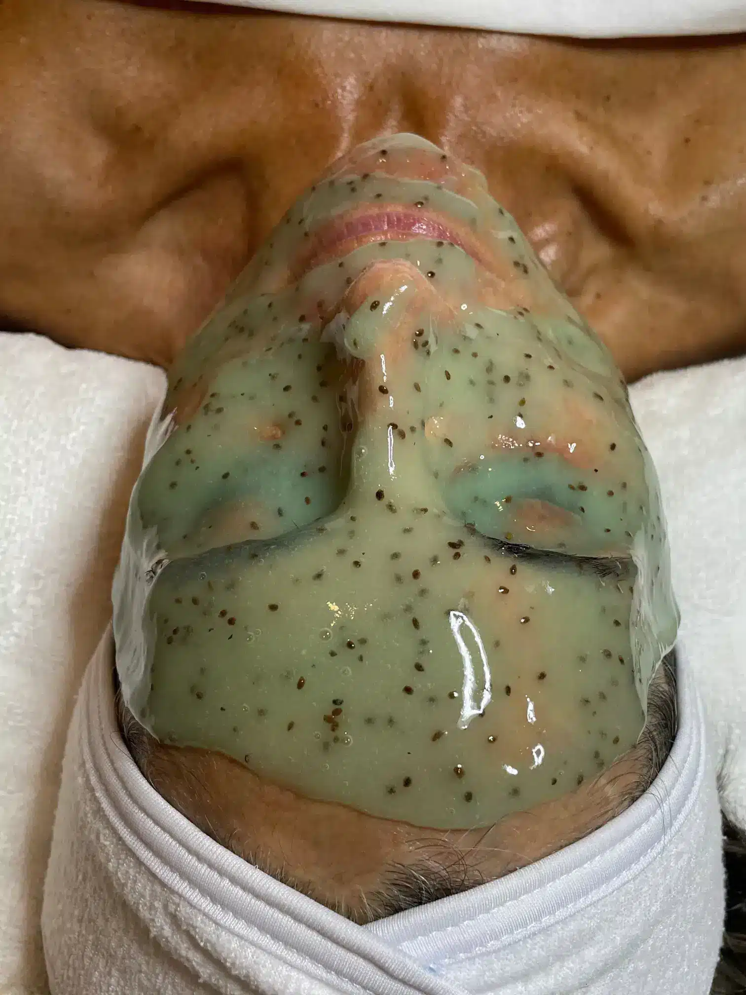 Facial Treatment in Houston at Dermaluxe Spa