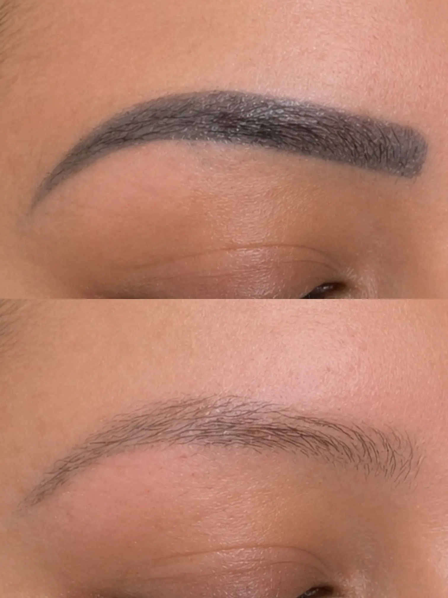 Microblading removal in Houston - Dermaluxe Spa -before and after