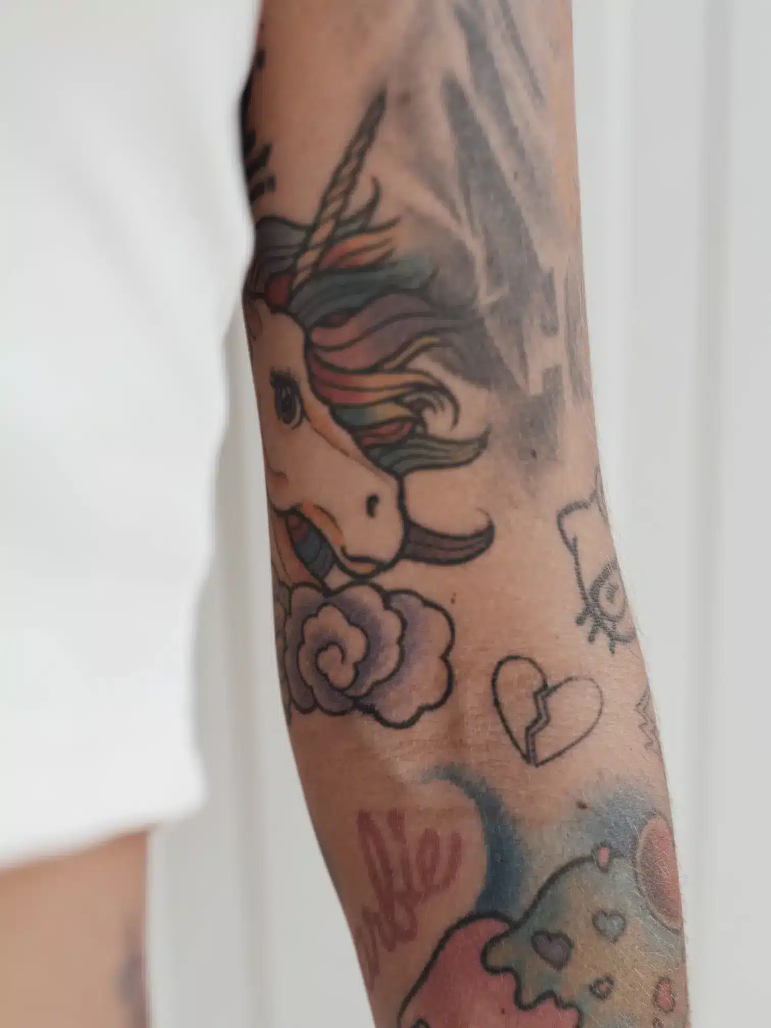 Tattoo Removal in Houston at Dermaluxe Spa