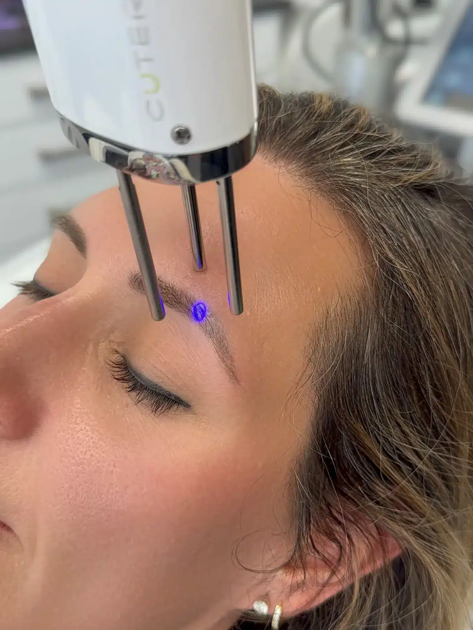 permanent makeup removal in houston dermaluxe spa